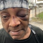 andre howton injuries